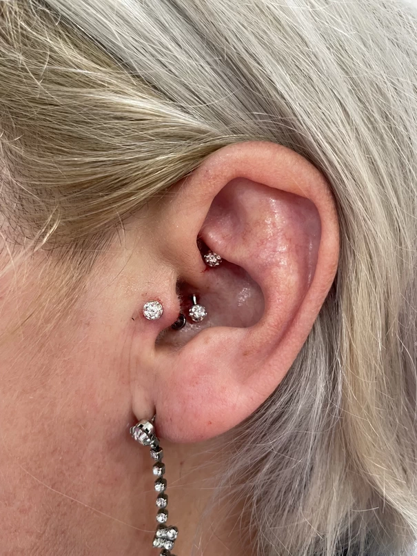Gyógypiercing szolnok slim Shenmen Migrén -Daith- Piercing_11